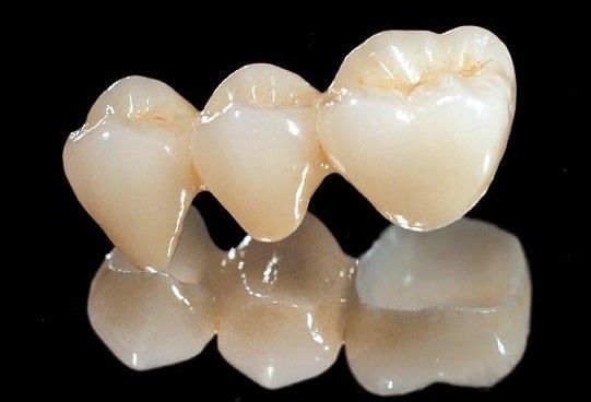 ครอบฟันเซรามิกเซอร์โคเนียทั้งหมด