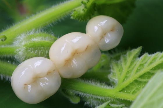 ครอบฟันเซรามิกเซอร์โคเนียทั้งหมด