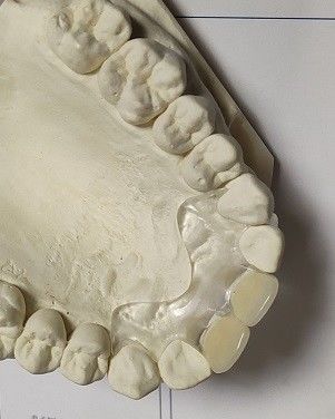 ใส่สบาย ISO13485 RPD Soft Invisible Denture