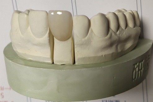 Zirconia Blocks ทันตกรรม 3D พิมพ์โดย CAD CAM Milling