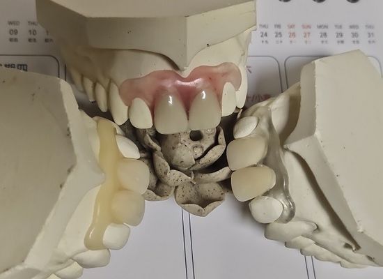 ใส่สบาย ISO13485 RPD Soft Invisible Denture