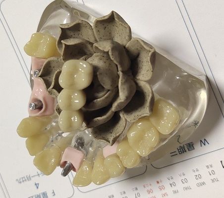 PMMA Provisional Crown ที่เข้ากันได้ทางชีวภาพ 100 เปอร์เซ็นต์