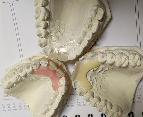 ฟันปลอมล่องหน Valplast นุ่มและยืดหยุ่นชั่วคราว