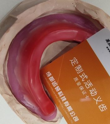 ISO13485 ขอบแว็กซ์ฟันแบบไม่มีฟันผลิตภัณฑ์ทันตกรรมอื่น ๆ