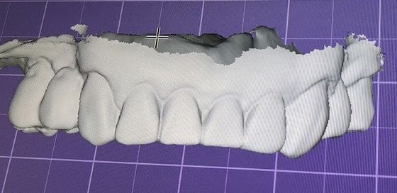 3D Digital Mock Up Teeth ผลิตภัณฑ์ทันตกรรมอื่น ๆ