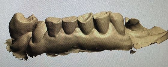 3D Digital Mock Up Teeth ผลิตภัณฑ์ทันตกรรมอื่น ๆ