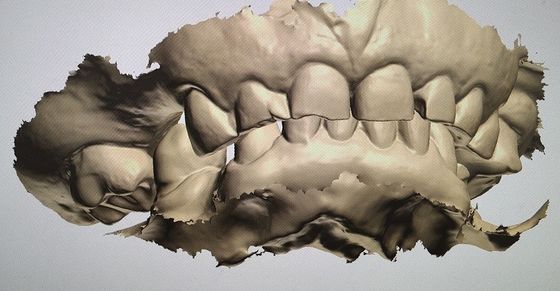 CAD CAM Design Digital Display Mockup Teeth ผลิตภัณฑ์ทันตกรรมอื่น ๆ