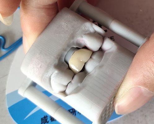 ห้องปฏิบัติการ PFM Dental Crown สะพานการพิมพ์ 3 มิติ Dental Crown