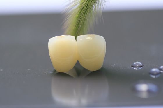 กรอบงานพิมพ์ 3 มิติ PFM Dental Lab Crown สำหรับทันตกรรม