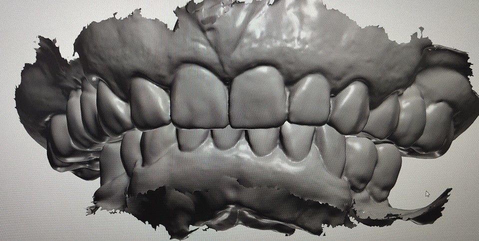 CAD CAM Design Digital Display Mockup Teeth ผลิตภัณฑ์ทันตกรรมอื่น ๆ