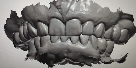CAD CAM Design Digital Display Mockup Teeth ผลิตภัณฑ์ทันตกรรมอื่น ๆ